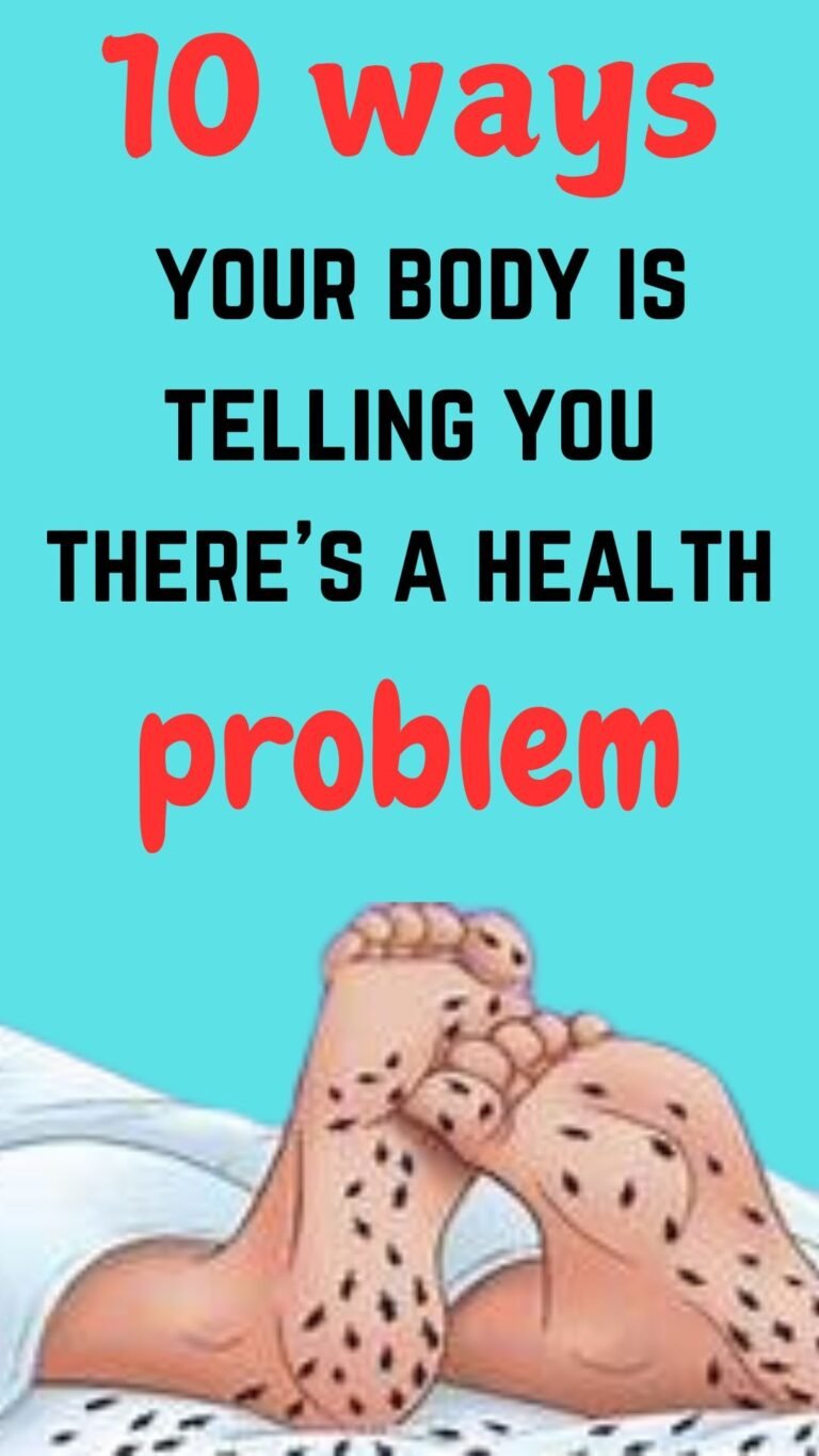 health issue